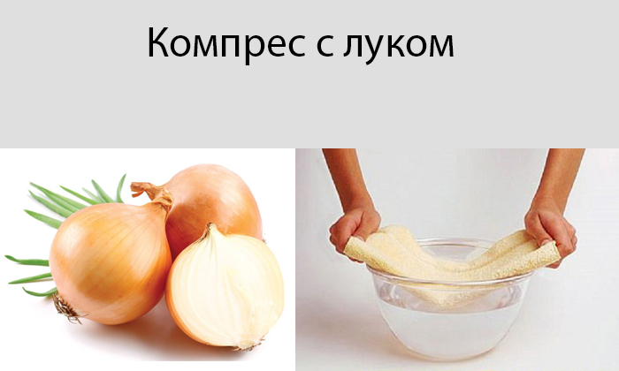 Особенно часто лук применяется в виде компрессов