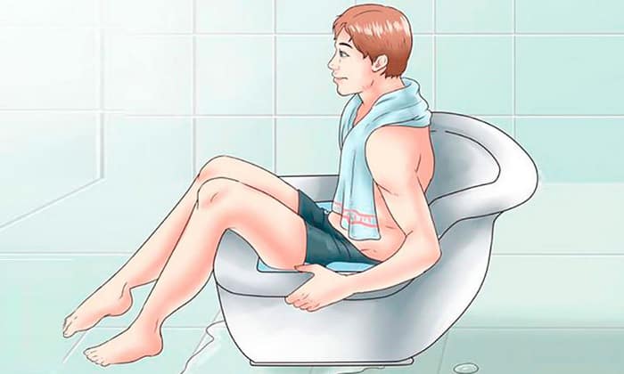 Как лечить увеличенные и выпадающие геморроидальные узлы