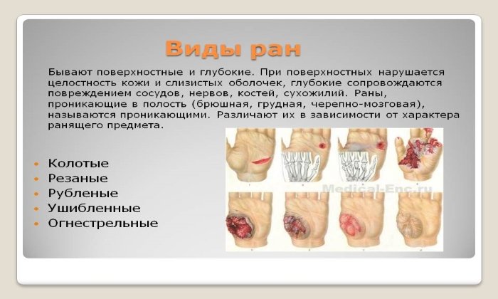Препарат применяется при лечении ран различной природы и тяжести, в т. ч. и послеоперационных